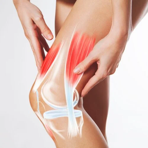 Knee,Pain,,Meniscus,Inflamed,,Human,Leg,Medically,Accurate,Representation,Of